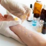 Patch Testing Requirements for Cosmetics